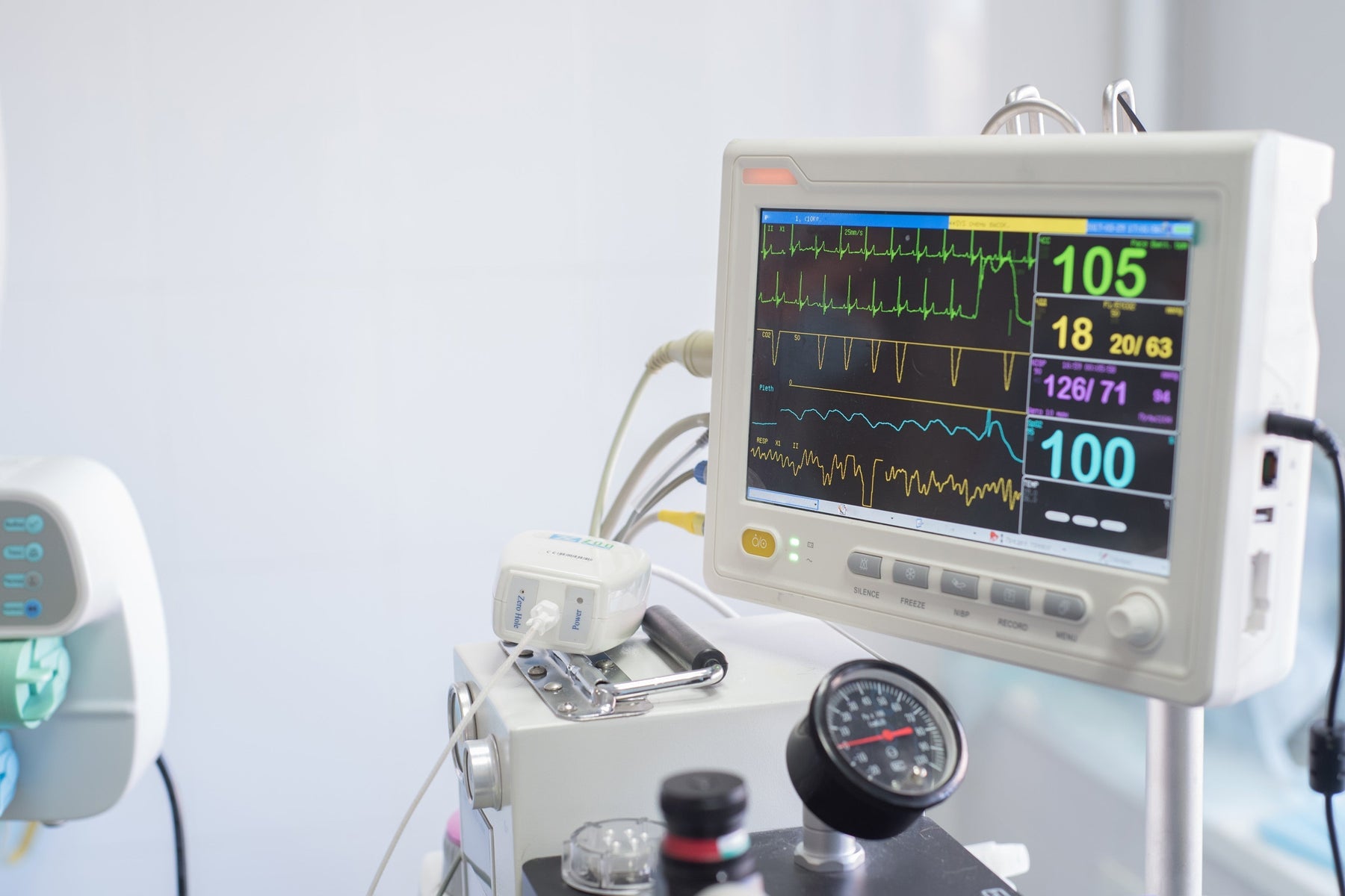 Unlock Value: Top Trends in Used Anesthesia Equipment for 2026