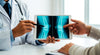 Portable X-Ray Machines Are Reshaping Mobile Imaging in 2026