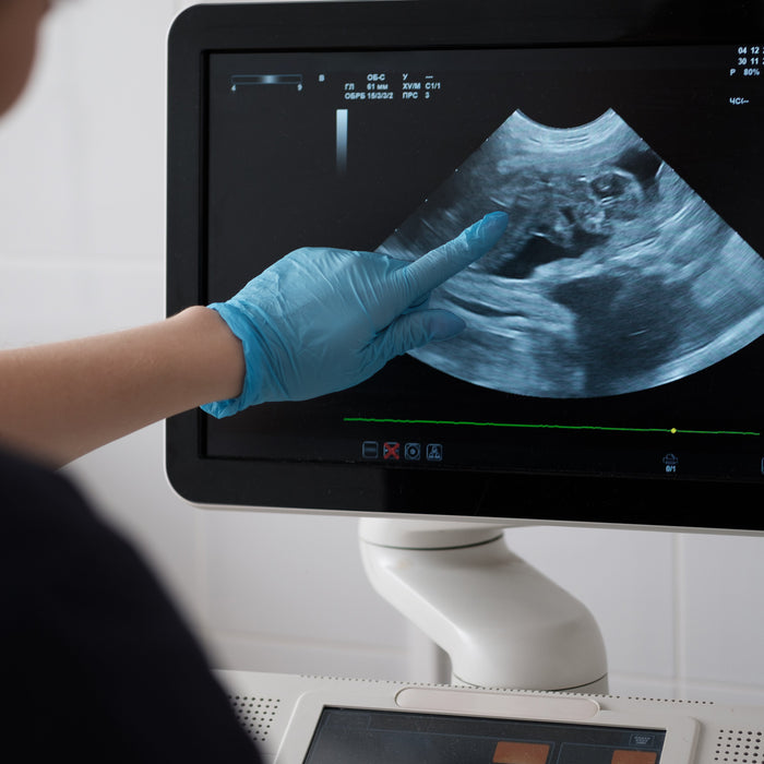 Conquer the Used Ultrasound Market: Your 10-Question Blueprint for Smart Buys