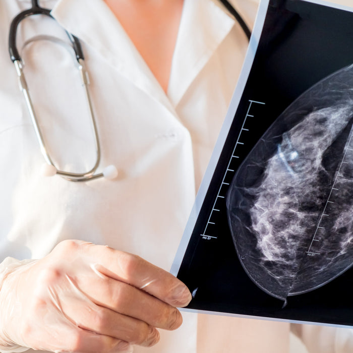 Why More Imaging Providers Are Purchasing Refurbished Mammography Systems