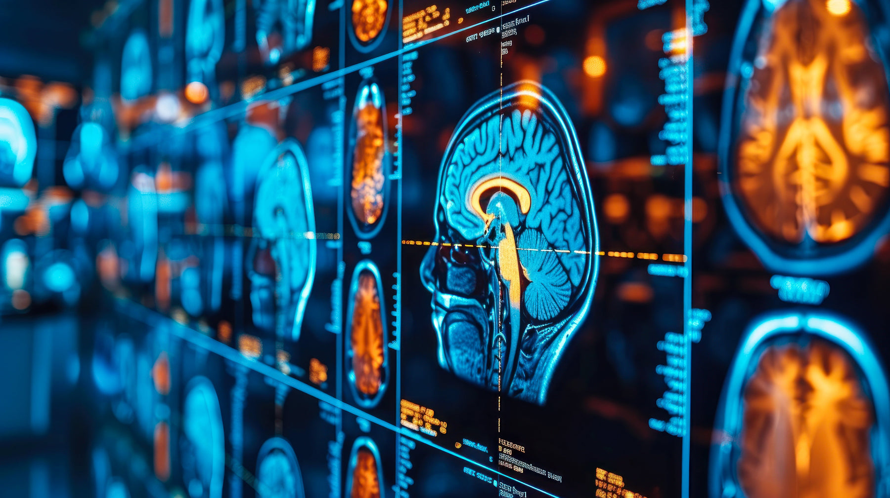 The Imaging Equipment Market in 2026: How Medical Equipment Vendors Can Win in a High-Value Category