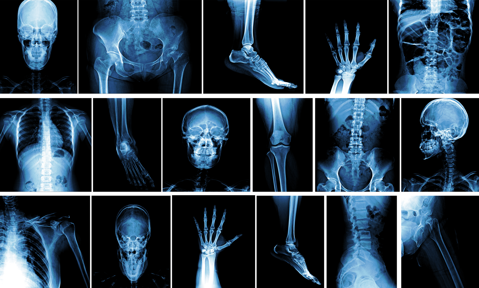How to Choose the Best X-Ray Equipment for Your Facility