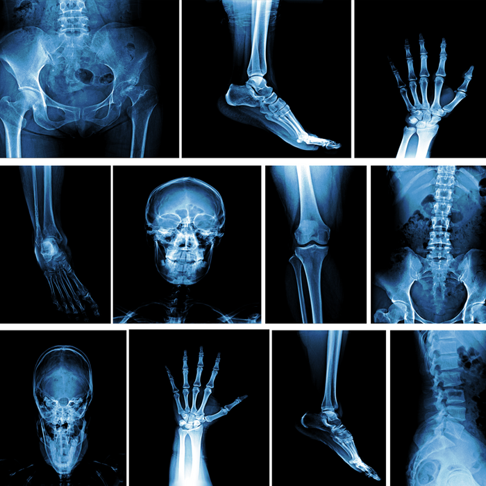 How to Choose the Best X-Ray Equipment for Your Facility
