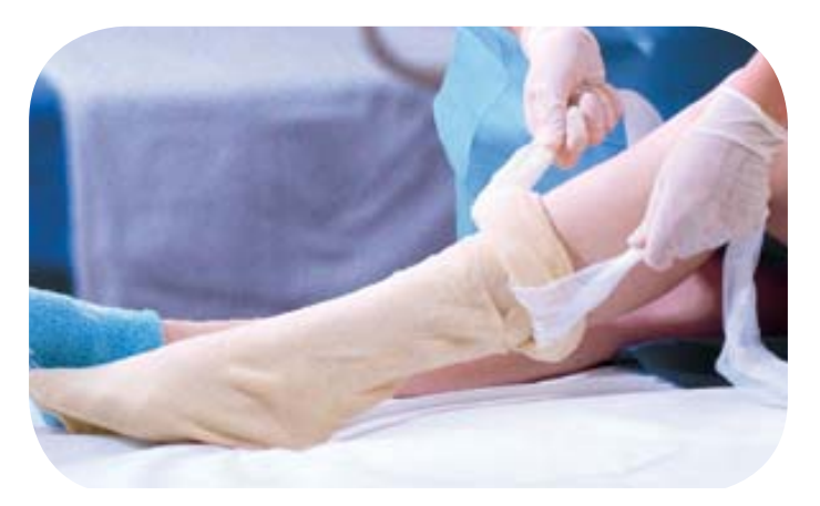 Albahealth, LLC (Encompass Company) Albahealth LLC 87665 Double-Ply Stockinette 6" x 60" Supplies reLink Medical