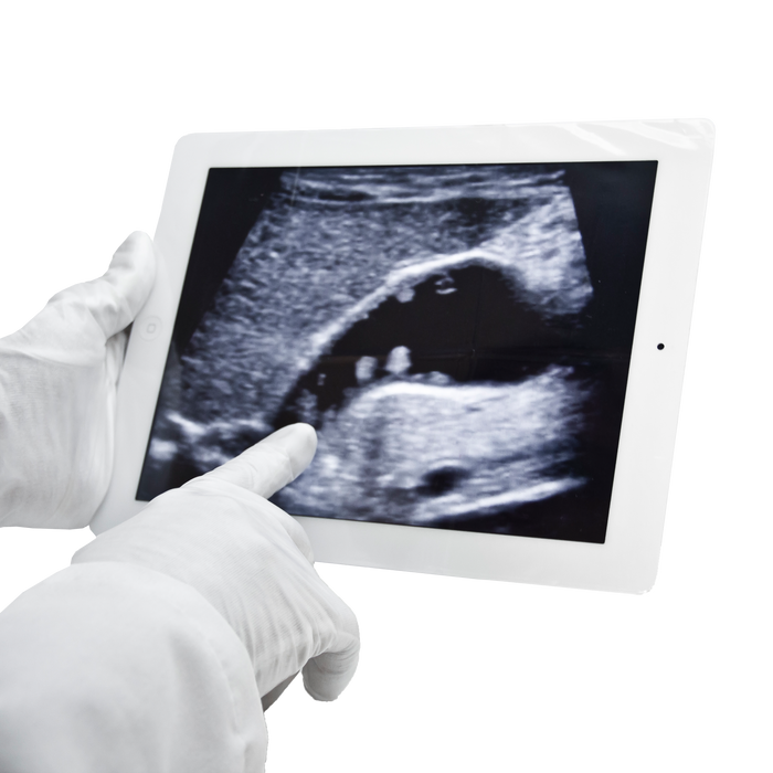 Aspen Surgical 1-519-1028 Smartphone Cover w/Adhesive Seal 8" x 10"