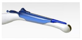 Aspen Surgical Aspen Surgical 1-535-5560 Endocavity Needle Guide Sterile Supplies reLink Medical