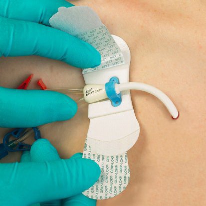 TIDI Products, LLC TIDI Products LLC 3308MCS-MC Securement Device MEDCOMP Dialysis Supplies reLink Medical