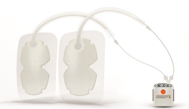 Smith & Nephew Smith & Nephew Inc. 66022031 PICO 7Y KitPump Pump Clip Supplies reLink Medical