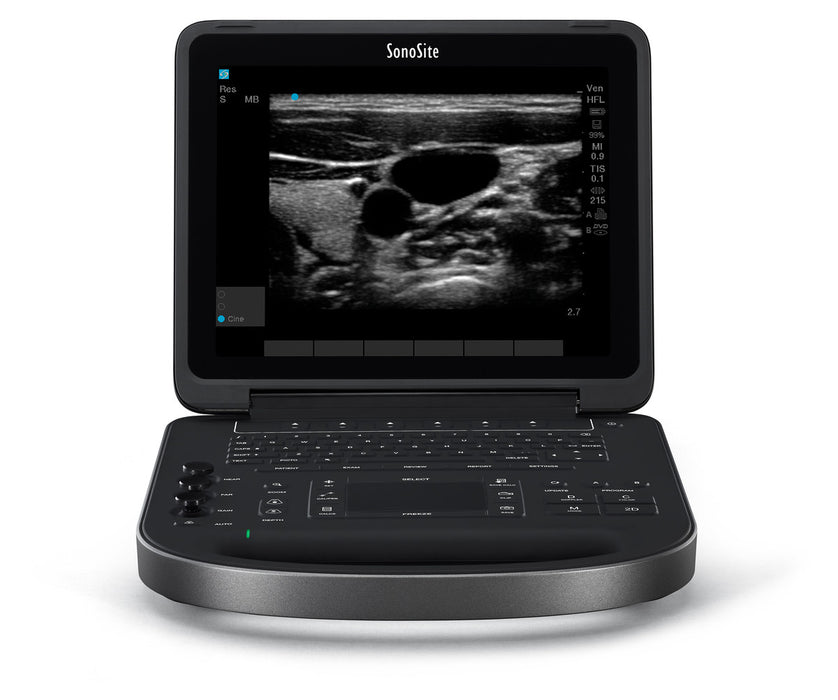 Fujifilm SonoSite Edge II/Edge 2 Total Ultrasound Machine