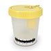 Globe Scientific, Inc. Globe Scientific Inc. 3856TP TransferTop Urine Collection Container Supplies reLink Medical