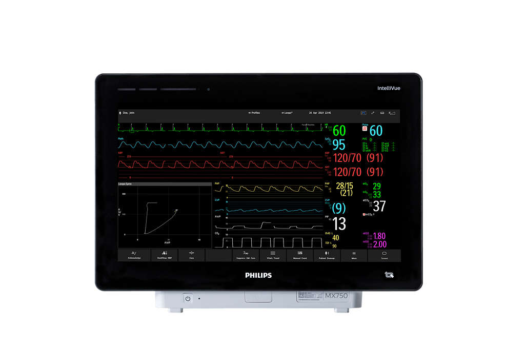 Philips MX750 Patient Monitor