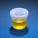 Globe Scientific, Inc. Globe Scientific Inc. 5917 Urine Collection Container Wide Mouth 5 Supplies reLink Medical