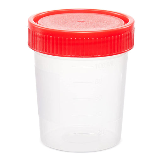 Globe Scientific, Inc. Globe Scientific Inc. 5915 Urine Collection Container 100 mL PP Supplies reLink Medical