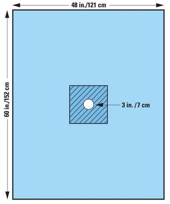 O&M Halyard O&M Halyard 89207 Minor Procedure Fenestrated Drape Medium Supplies reLink Medical