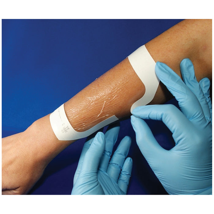 AMD-Medicom AMD-Medicom A60044 Transparent Dressing 4" x 4‚¾" 40/pk 4 Supplies reLink Medical