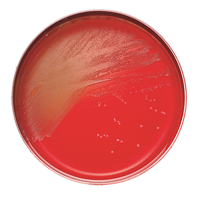Becton Dickinson (BD) BD 221353 BBL Columbia CNA Agar Plate with 5% Sheep Blood Supplies reLink Medical