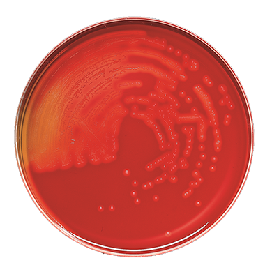 Becton Dickinson (BD) BD 221289 Trypticase Soy Agar II 5% Sheep Blood Levine EMB Agar Supplies reLink Medical