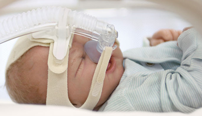 Zoll Medical 777002XL Nasal Mask X-Large Clear