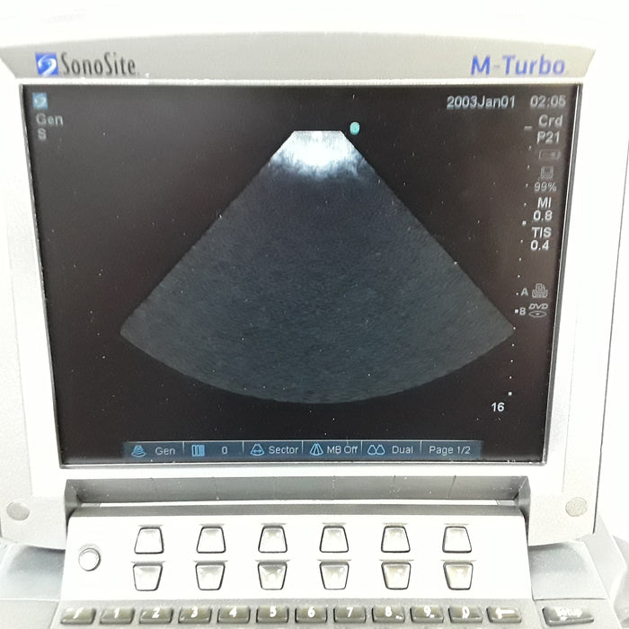 Sonosite M-Turbo Ultrasound