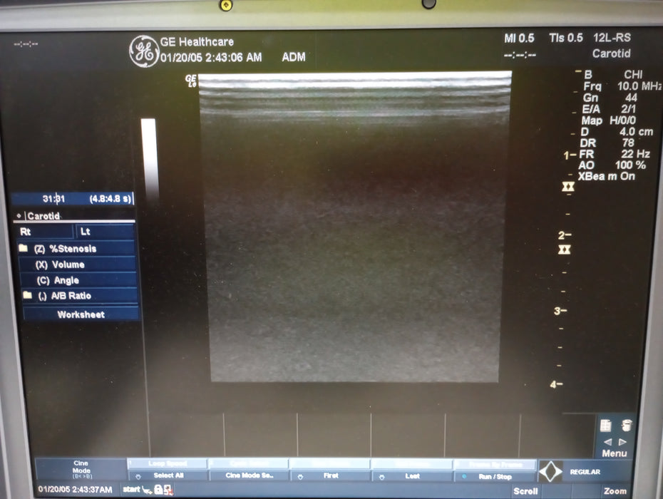 GE Healthcare Logiq E Ultrasound