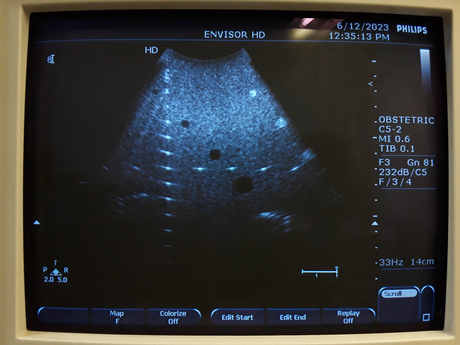 Philips C5-2 Curved Array Ultrasound Transducer