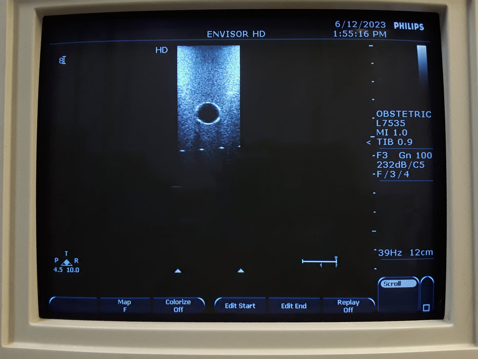 Philips L7535 Ultrasound Probe