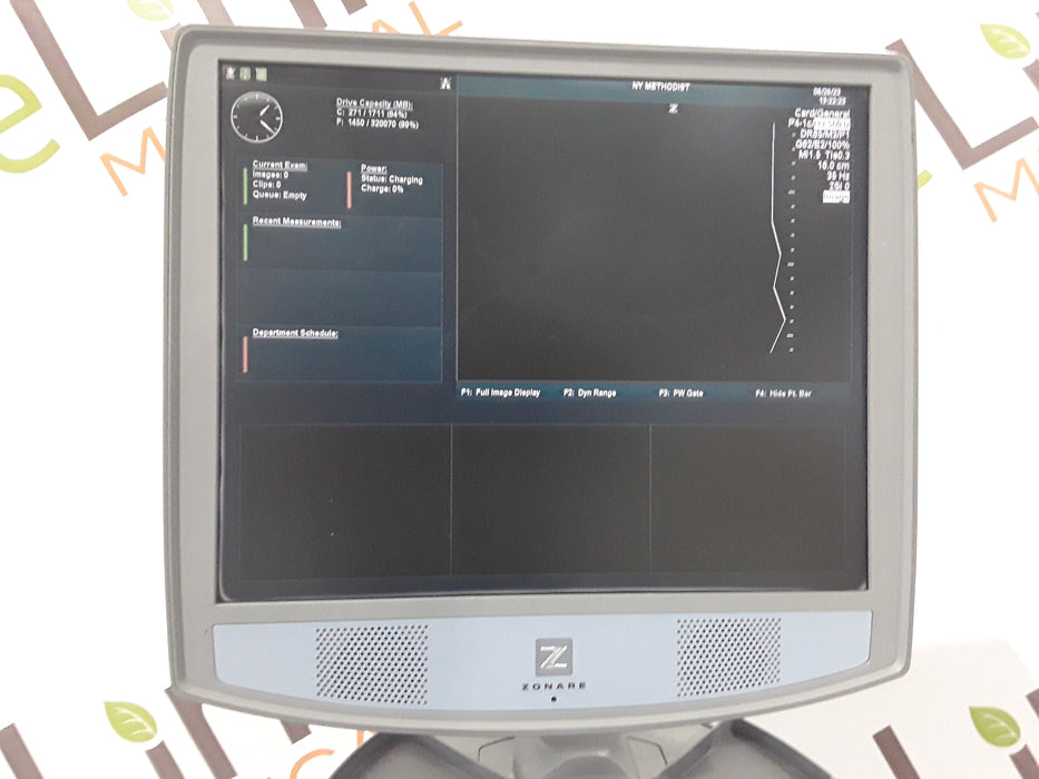Zonare Z. One SmartCart Ultrasound