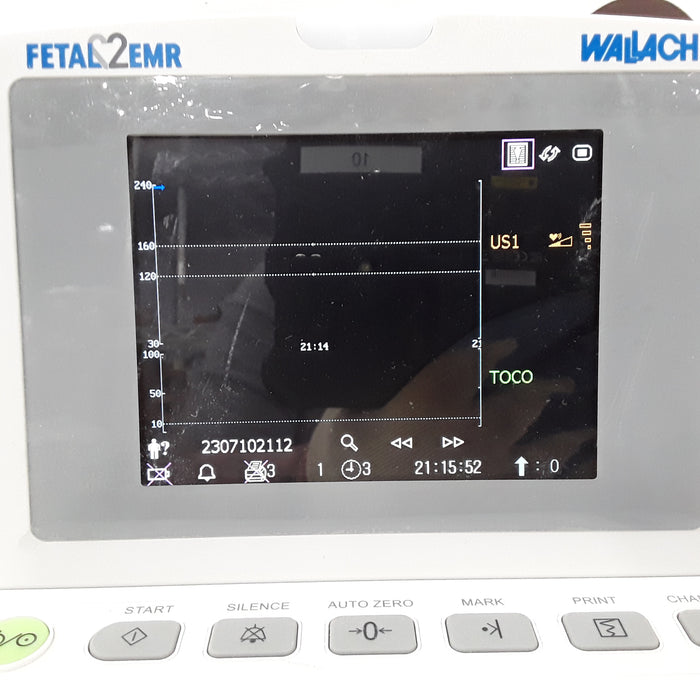 Wallach F3 Fetal Monitor