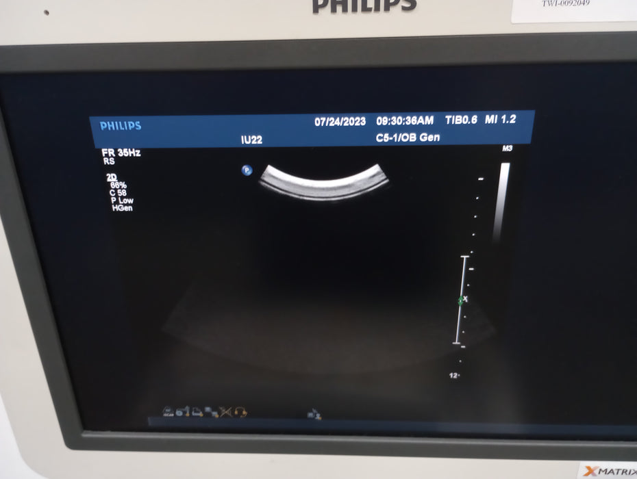 Philips IU22 Ultrasound Machine