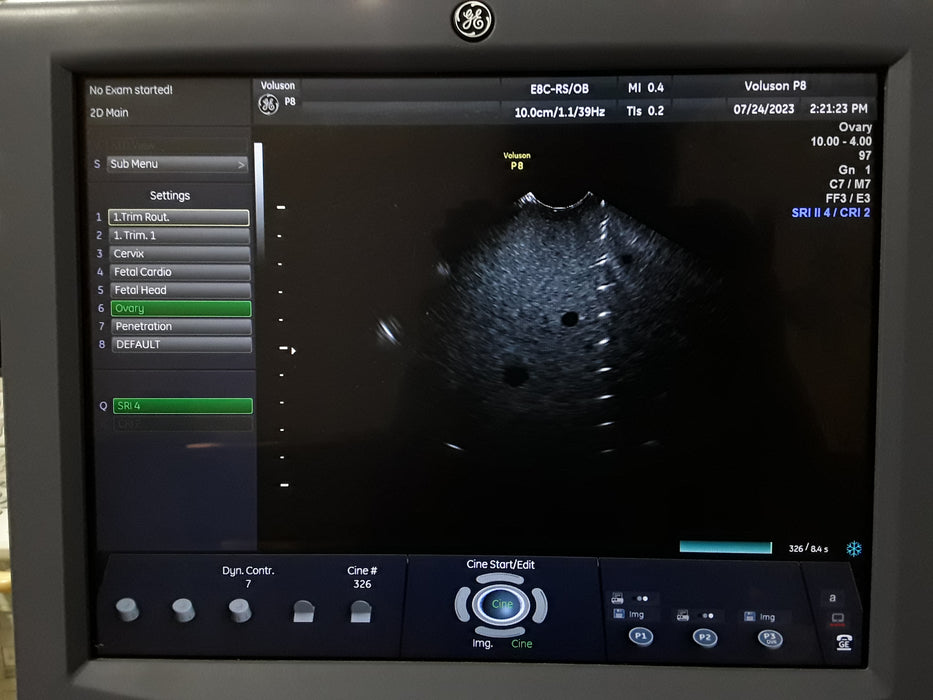 GE Healthcare Voluson P8 Ultrasound