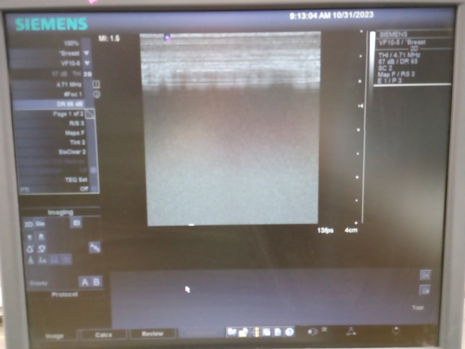 Siemens Antares Sonoline Ultrasound
