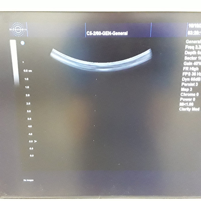 UltraSonix Sonix 1 Ultrasound