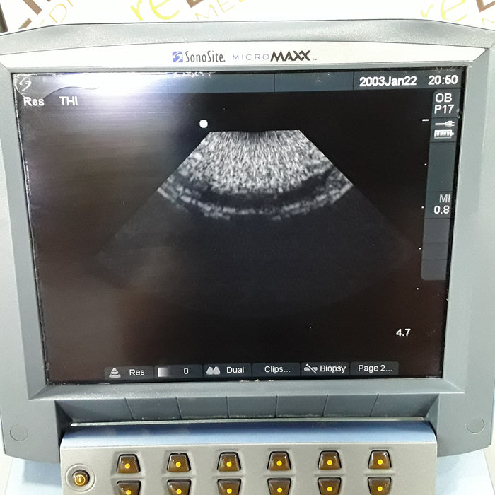 Sonosite Micromaxx Portable Ultrasound