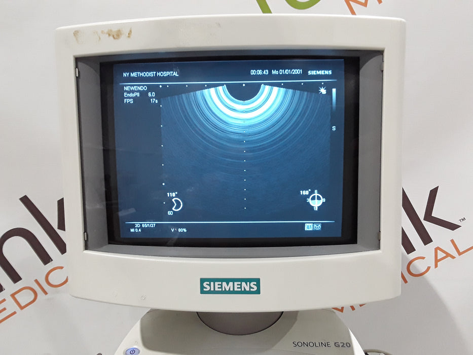 Siemens Sonoline G20 Ultrasound