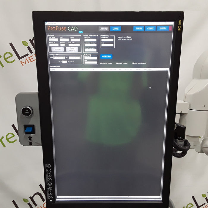 Eigen Artemis 3D Imaging Navigation for Prostate Biopsy