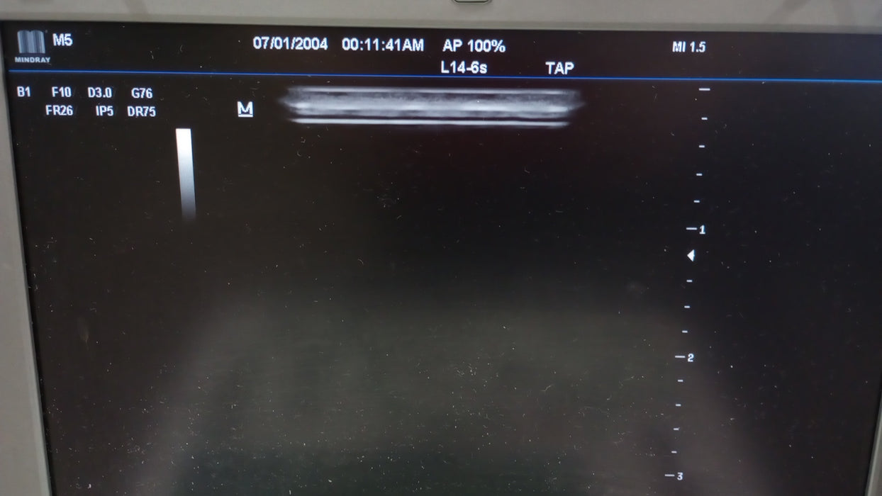Mindray M5 Ultrasound