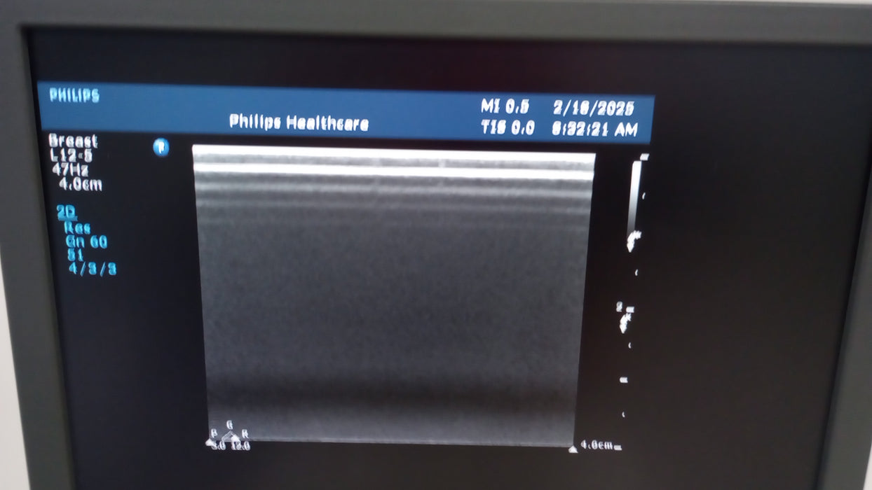 Philips Philips HD15 Ultrasound Ultrasound reLink Medical