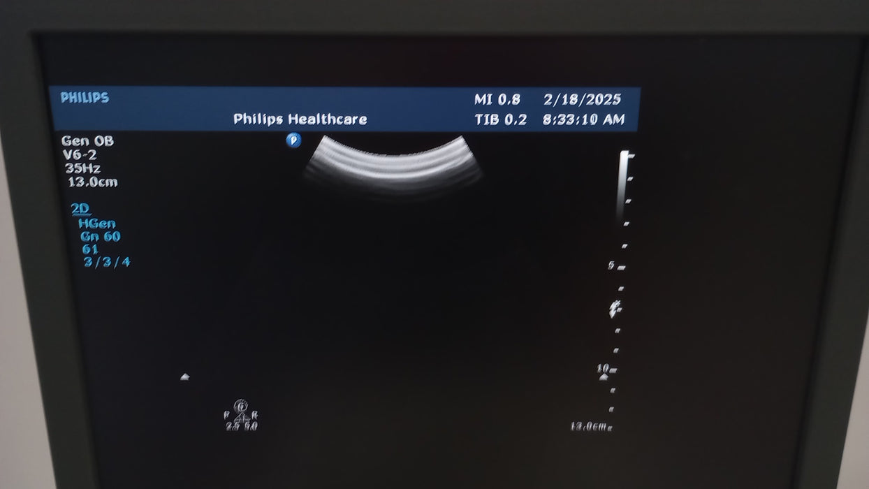 Philips Philips HD15 Ultrasound Ultrasound reLink Medical