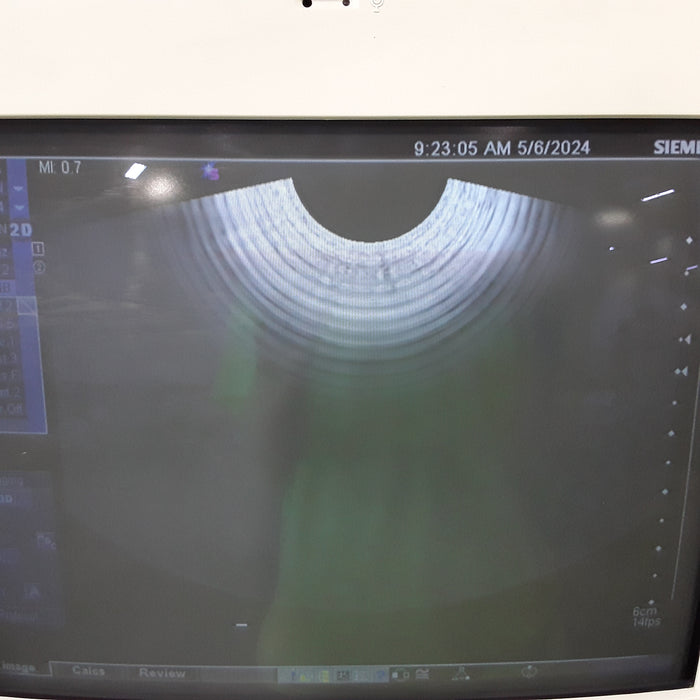 Siemens Antares Sonoline Ultrasound