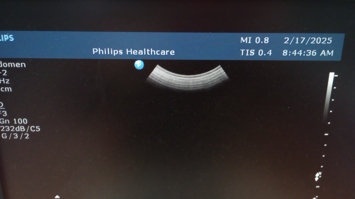 Philips Philips HD11XE Ultrasound Ultrasound reLink Medical