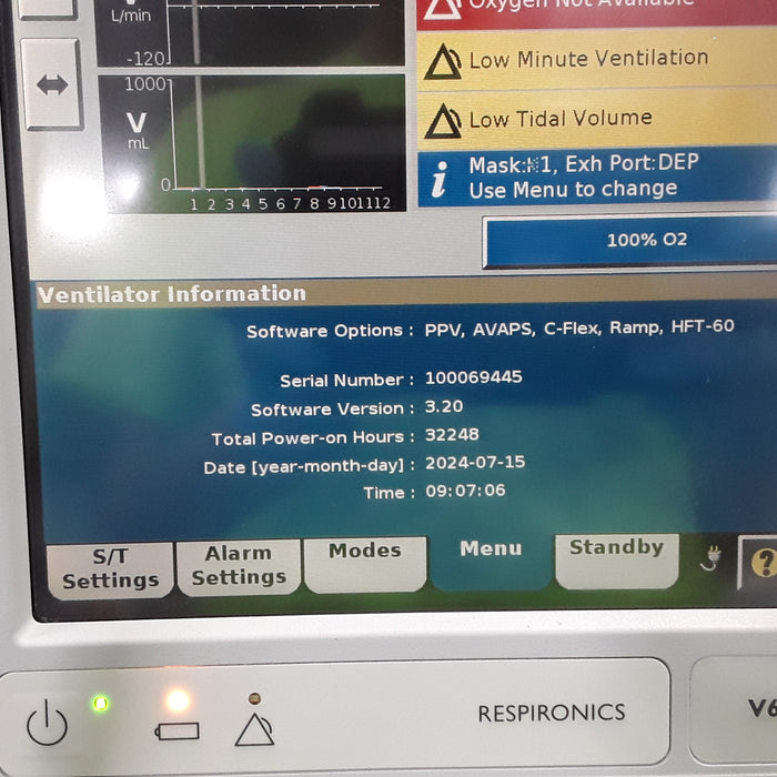 Respironics V60 BiPAP Ventilator