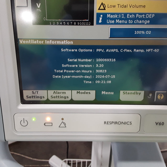 Respironics V60 BiPAP Ventilator