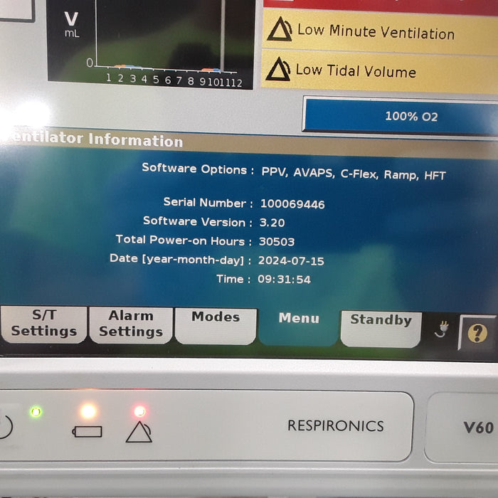 Respironics V60 BiPAP Ventilator