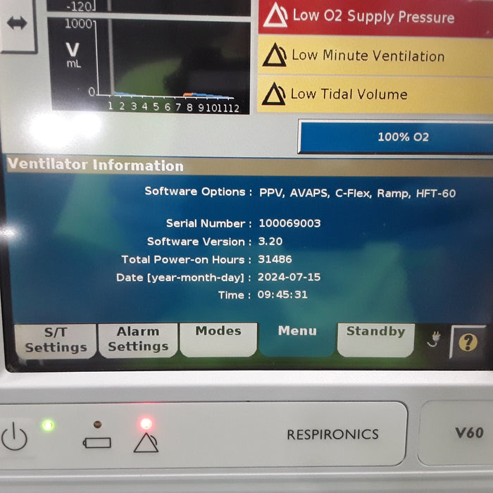 Respironics V60 BiPAP Ventilator