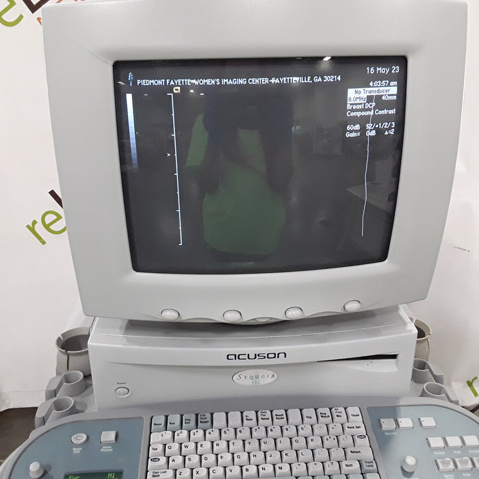 Siemens Sequoia Acuson 512 Ultrasound