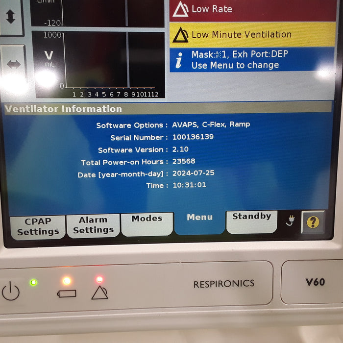 Respironics V60 BiPAP Ventilator