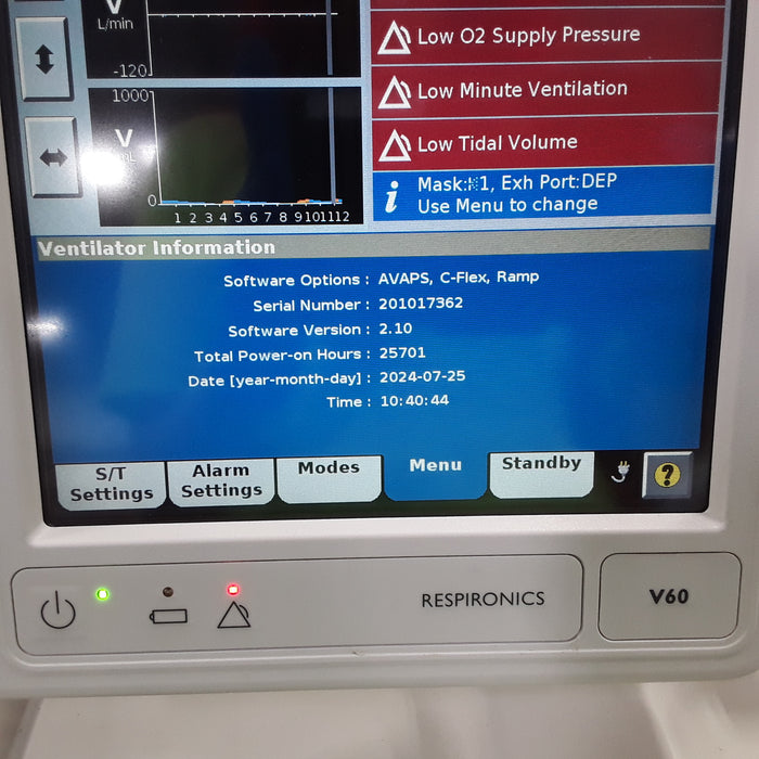 Respironics V60 BiPAP Ventilator