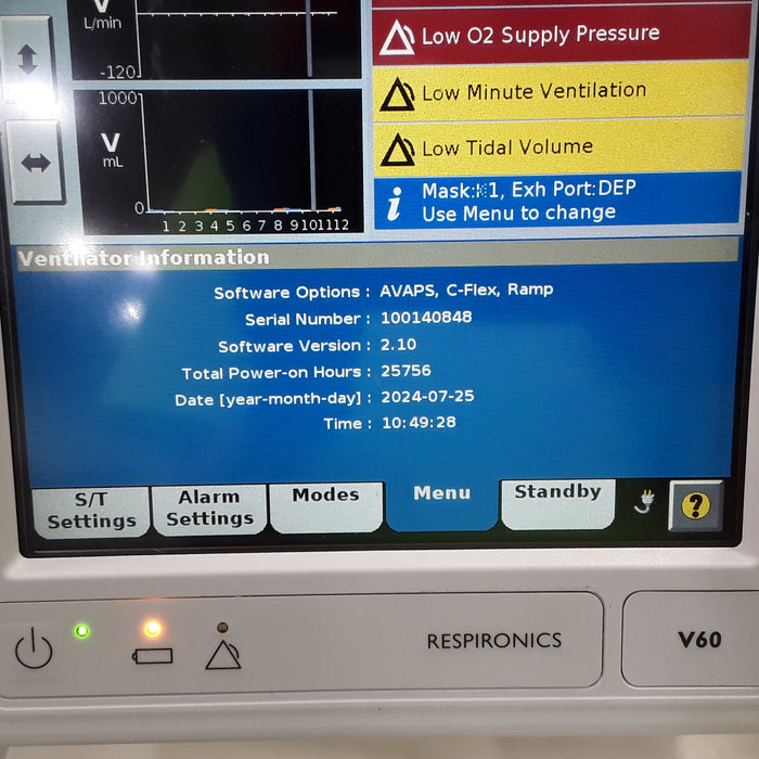 Respironics V60 BiPAP Ventilator