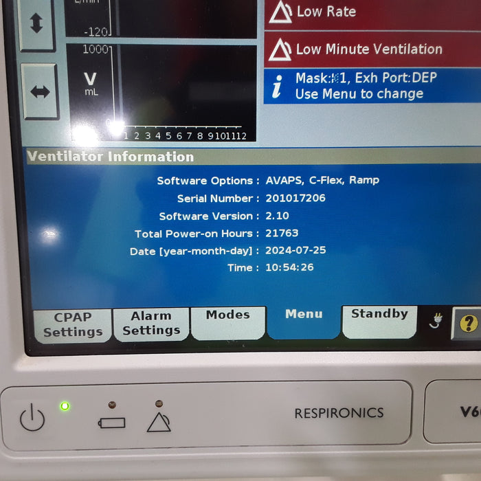 Respironics V60 BiPAP Ventilator