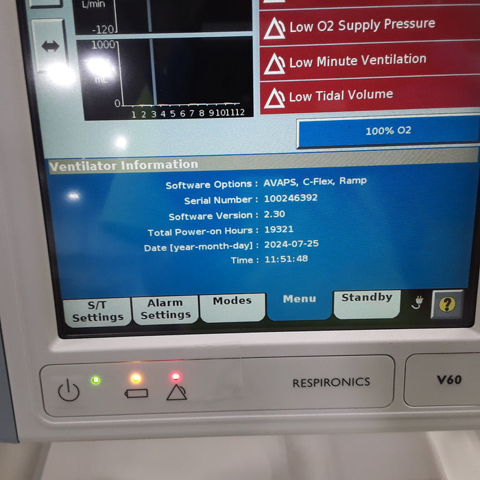 Respironics V60 BiPAP Ventilator